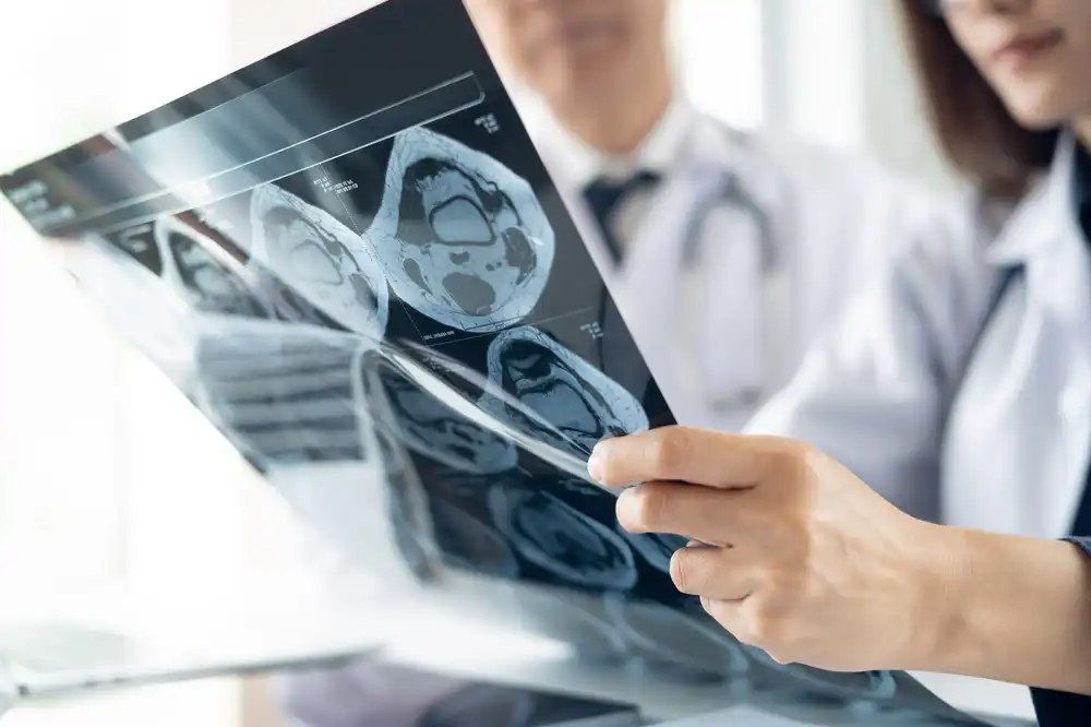 Two doctors in white coats holding and examining brain MRI scans