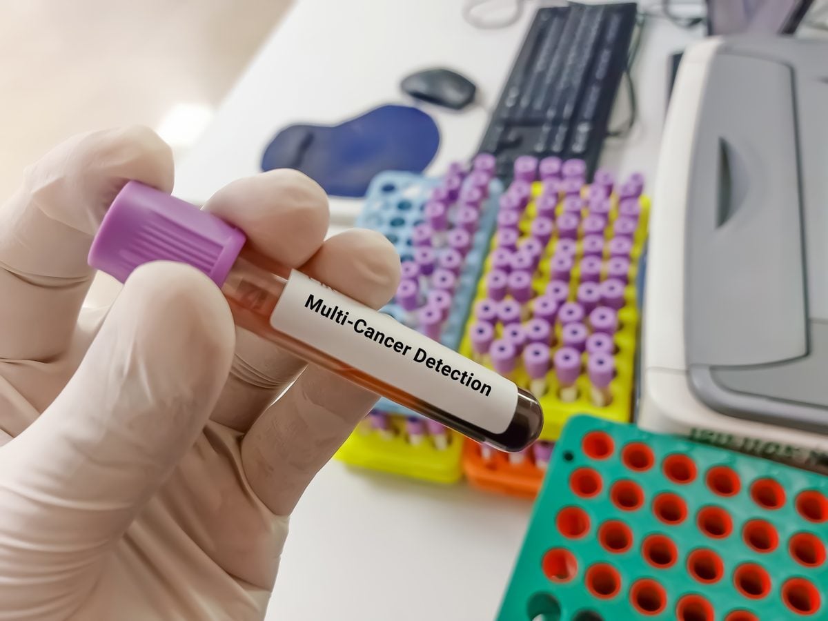 A gloved hand holds a blood sample tube labeled Multi-Cancer Detection in a lab.